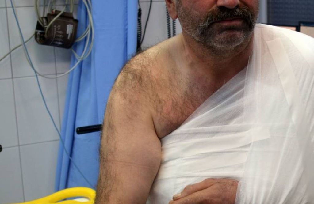 Bărbat de 50 de ani atacat de urs în propria gospodărie, în comuna Lunca de Sus