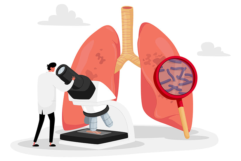 Program de depistare activă a tuberculozei în Sălaj